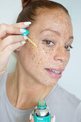 Urban Skin Rx Super C Brightening Serum | Lightweight Anti-Aging Glow Serum Hydrates, Brightens, Clarifies, and Evens Skin Tone, Formulated with Hyaluronic Acid and Salicylic Acid | 1.0 Fl Oz