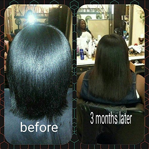J’Organic Solutions 100% Pure Organic Hair Growth for Women | Strengthening & Rejuvenating Follicle Fuel | Promotes Healthy hair grow.. (OIL FREE) - Duafe Beauty Collective